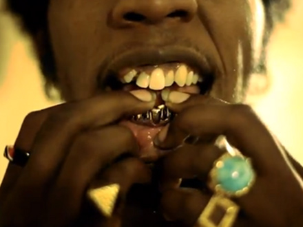 Trinidad James' missing and messed up teeth