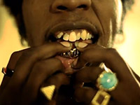 Trinidad James' missing and messed up teeth